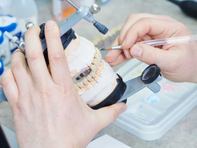 Prótese Dentária Fixa ou Móvel: Qual é a Opção Ideal para Você?