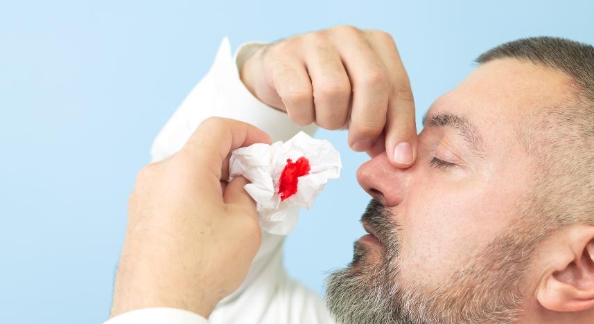 Cauterização de Epistaxe
