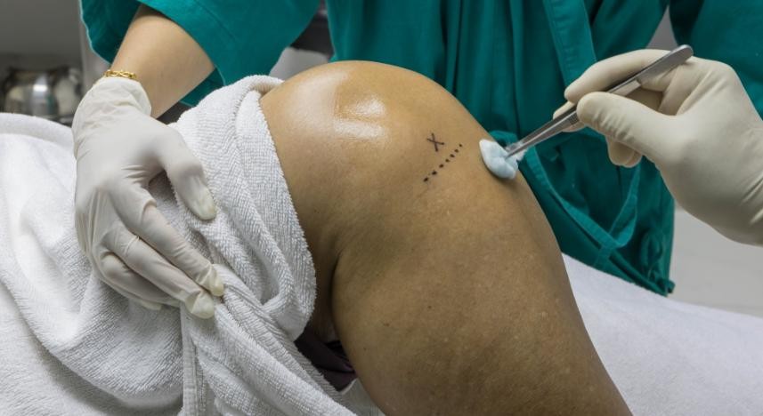 Infiltração de Corticoide Intra – Articular