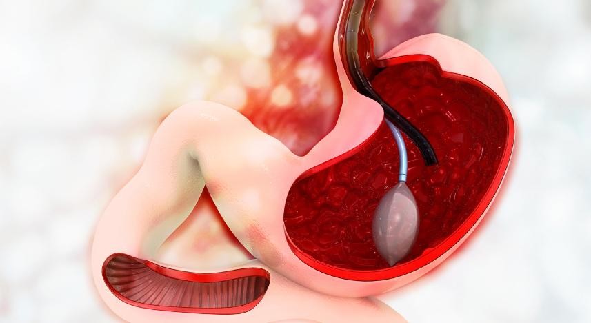 Endoscopia