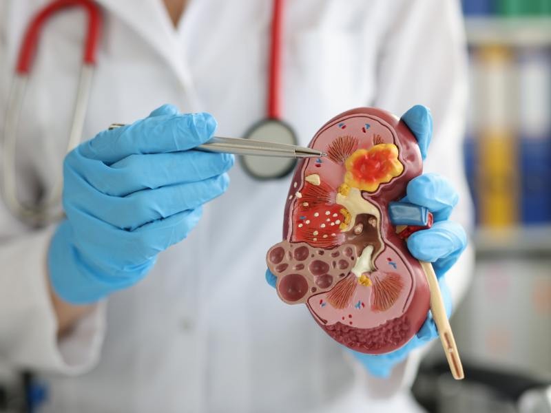 Combo Urologia